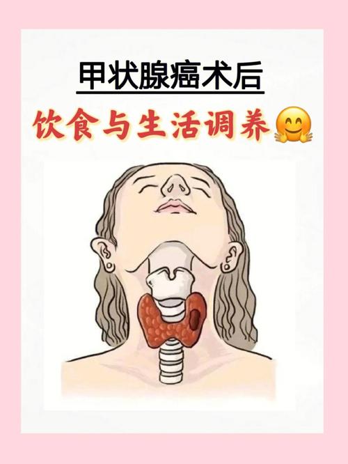 甲状腺癌术后在生活上怎样调养。