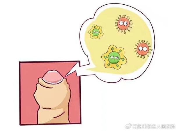 姑娘注意,男友的丁丁上长了这种「虫」,会影响生育
