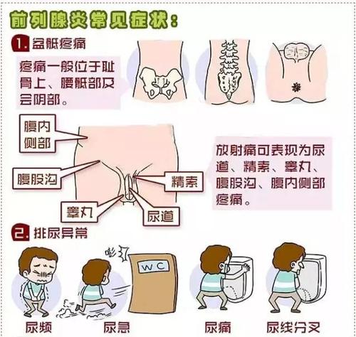 常见的前列腺疾病有哪些。都有什么症状。
