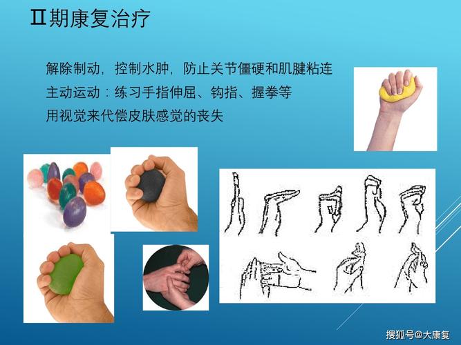 多指手术后的康复锻炼很重要，孩子该怎么进行锻炼呢。