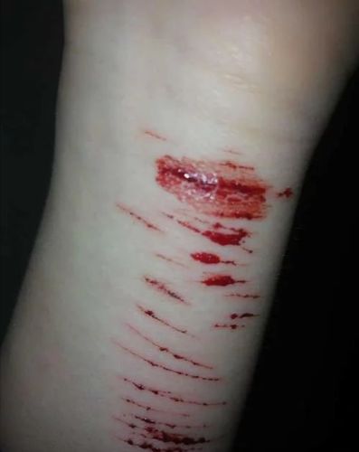 是什么导致孩子的自残、强势和抑郁。青少年心理咨询师带你了解