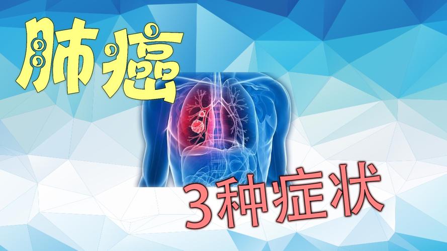 肺癌悄无声息。除了咳嗽,这3种不痛不痒的症状才是高危因素