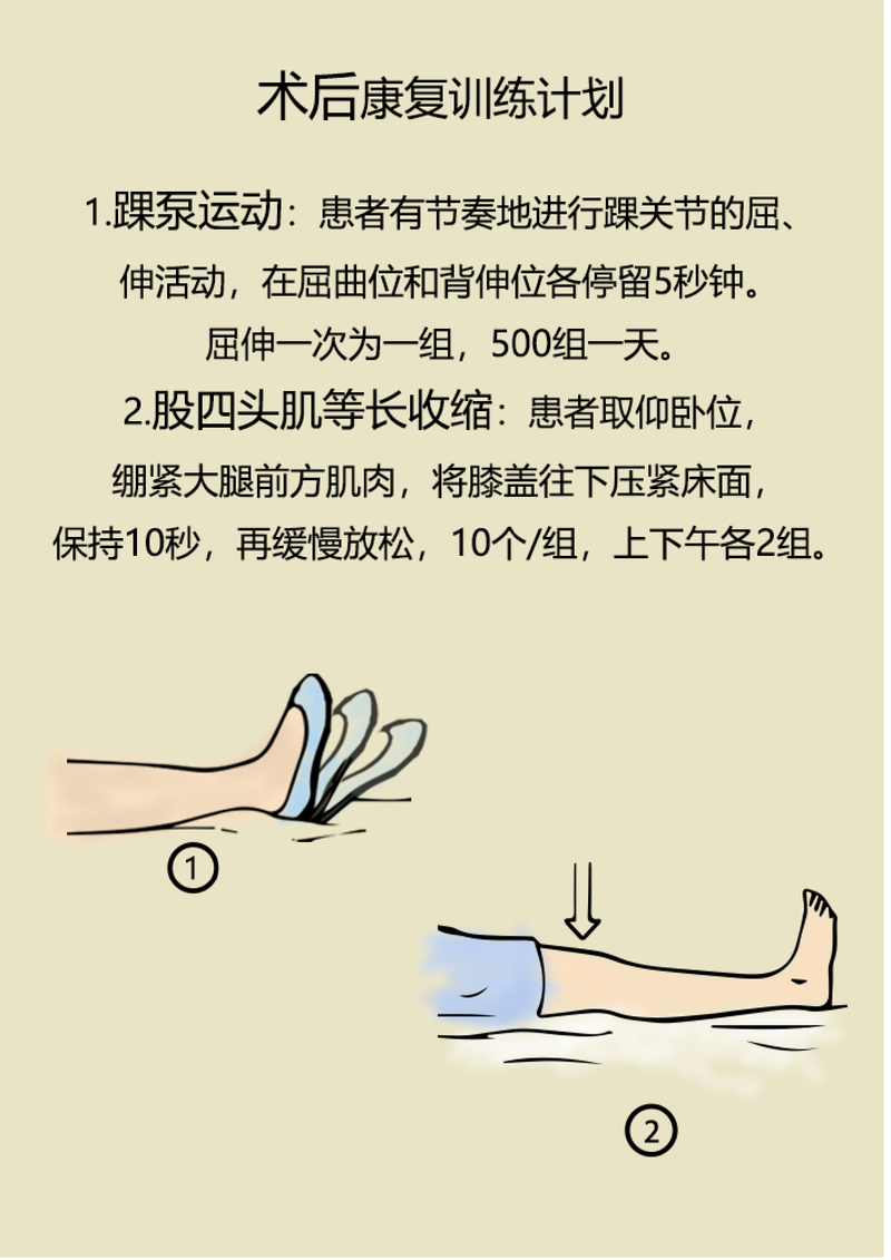 膝关节置换术后的常用康复治疗