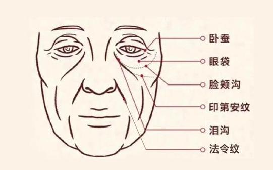 印堂常见的九种皱纹介绍
