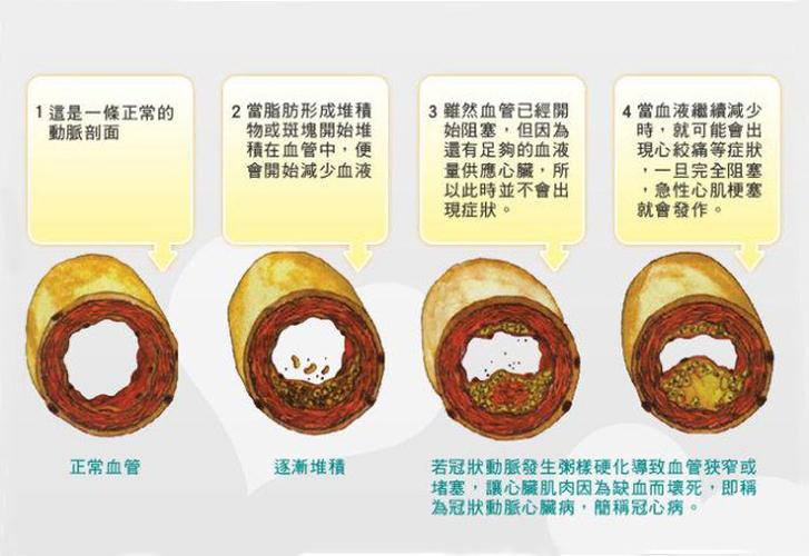 到底哪些行为会伤血管。在日常生活中，该如何养血管呢。