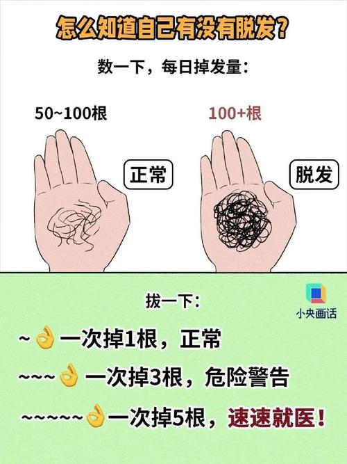 日常生活中,哪些事情习惯会加速脱发呢。