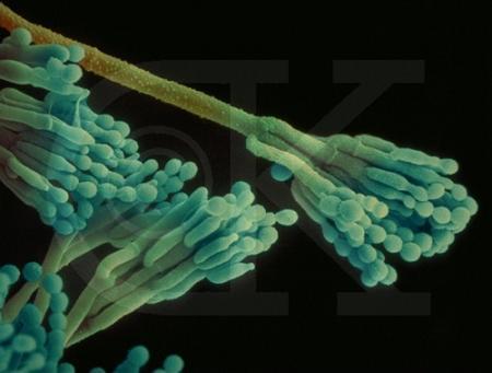 常见霉菌形态描述及典型菌落图片汇总