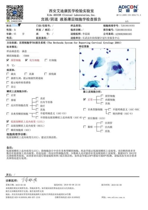 如何读懂液基薄层细胞学检测结果服务窗-体检报告怎么看