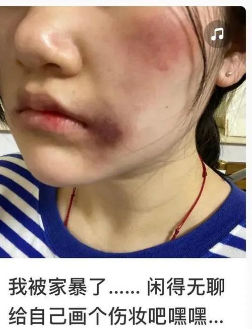 女网红自称被家暴晒“伤情照”,公然拿家暴题材拍搞笑段子引争议