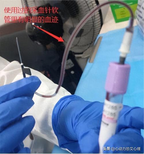 恐艾硬核科普恐护士恐抽血恐针头恐检测,抽血真的会感染艾滋病吗。