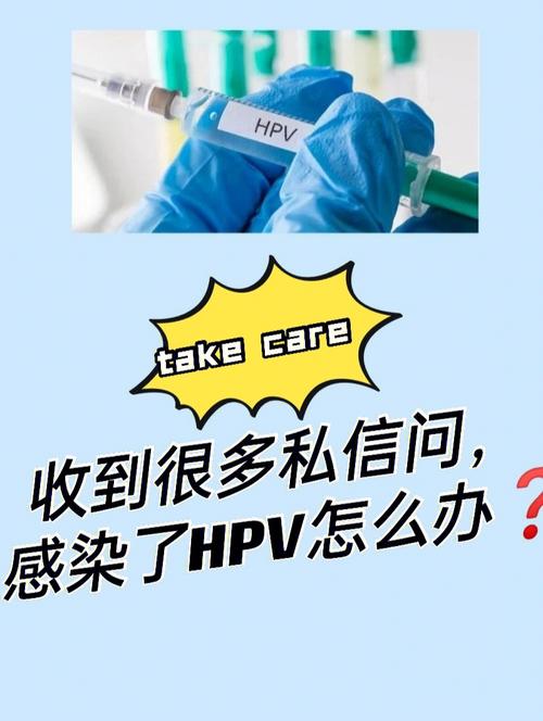 感染hpv的高危人群有哪些。太原纺织美容看hpv正规吗。