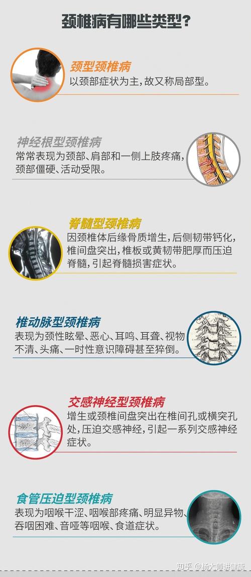 颈椎间盘源性痛是中老年人常见的颈椎退行性疾病,病程长易发作