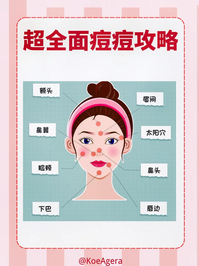 痘痘总是长不停,难以消除,要如何祛痘。别瞎治,要找对方法