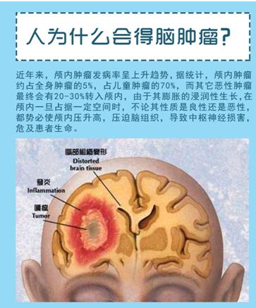 脑瘤一般能活几年