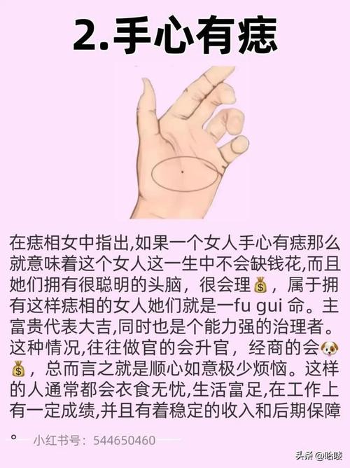 “有痣人士”对这种痣需谨慎,自查方法看过来~