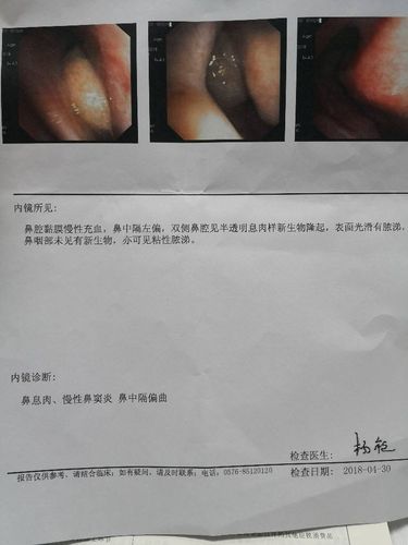 内窥镜检测维修报告：精益求精，守护医疗安全