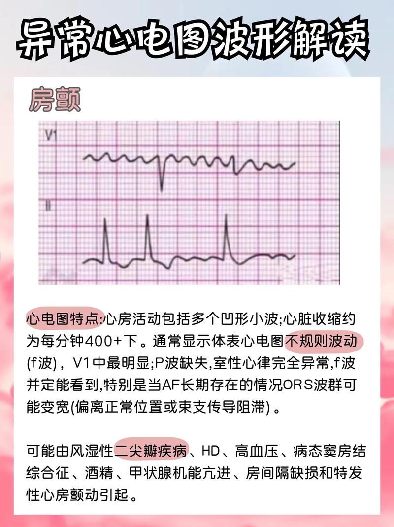 心电图机无波形故障介绍及维修报告