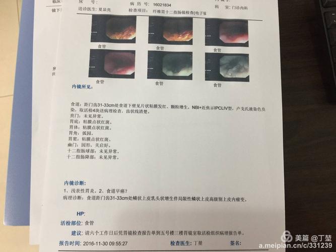 奥巴内镜维修合格报告介绍:品质与技术的完美结合