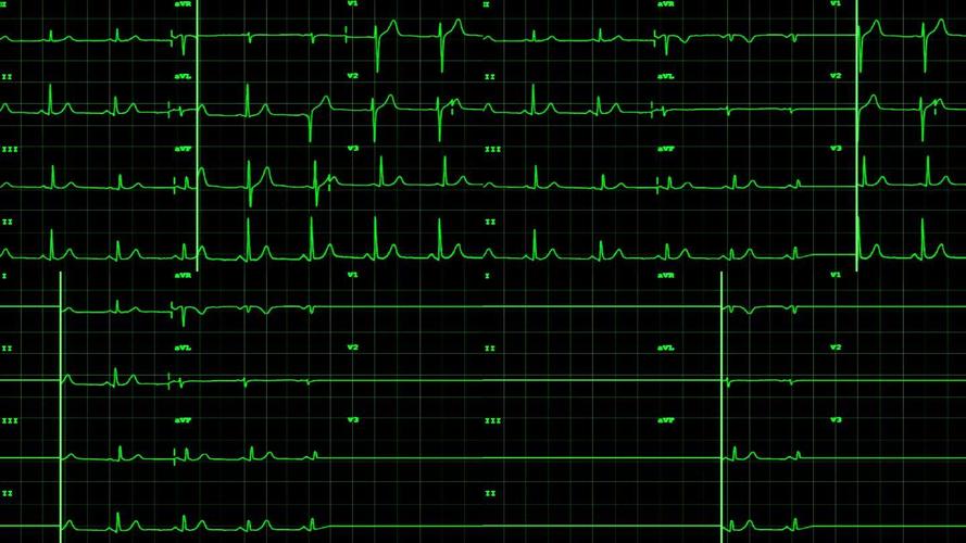 排碱系统维修报告解读:确保工业生产高效稳定的“心脏”跳动