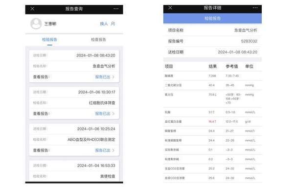电动门维修检查报告解读:安全与效率的双重保障
