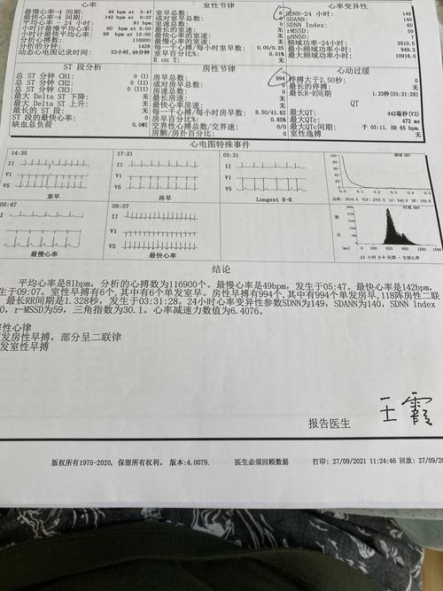 电源板维修报告介绍:介绍电子产品心脏的“起死回生”