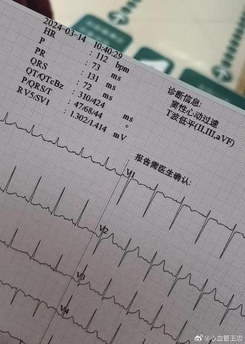 电路板维修报告介绍:介绍电子设备心脏的“起死回生”
