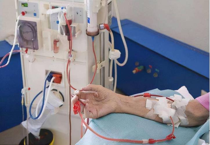 血透机维修报告单:介绍肾脏透析设备的维护之路