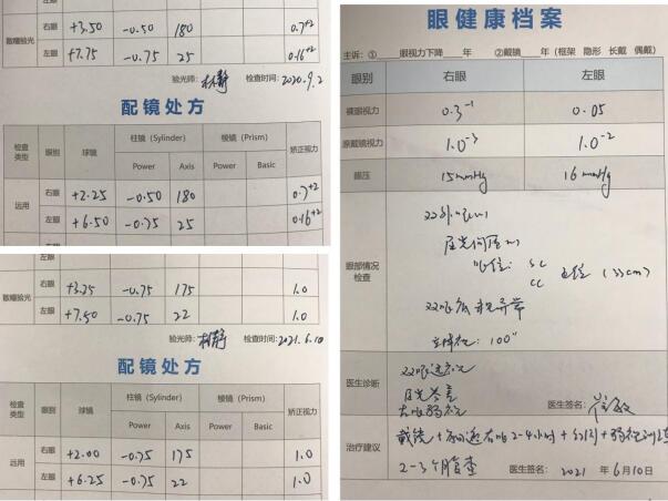 视界重生:从眼睛维修报告单看现代眼科技术的奇迹