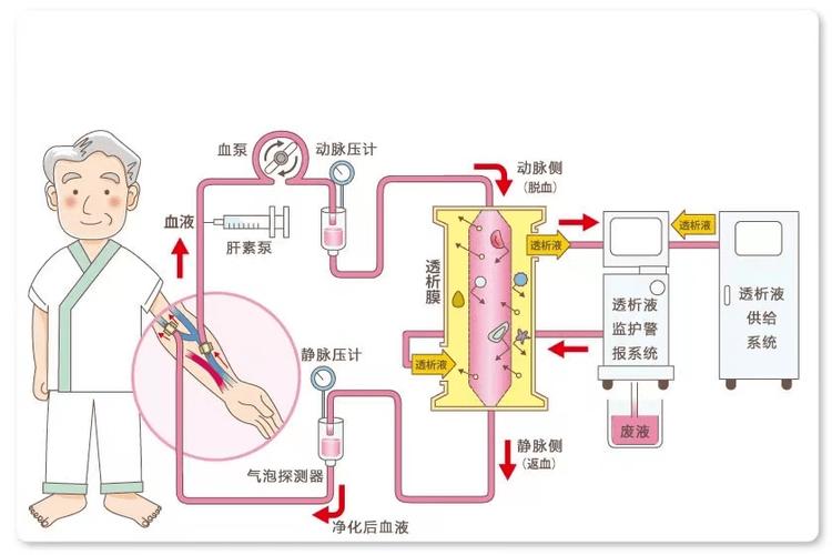 透析机维修报告单分析：保障患者生命线的精准守护
